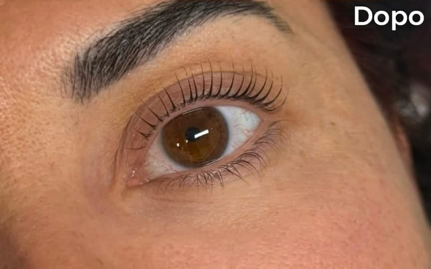 Prima e dopo di un Korean Lashlift, secondo caso