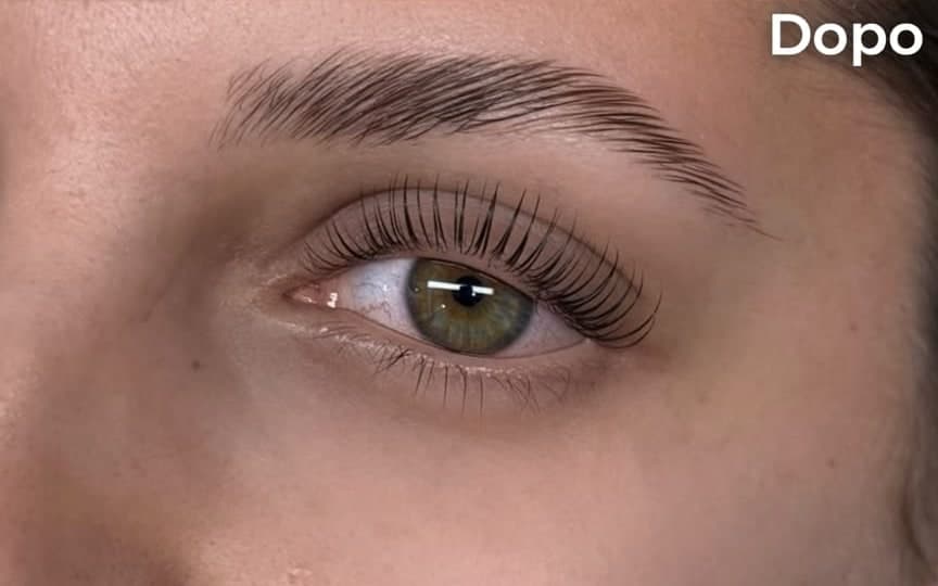 Prima e dopo di un Korean Lashlift, terzo caso