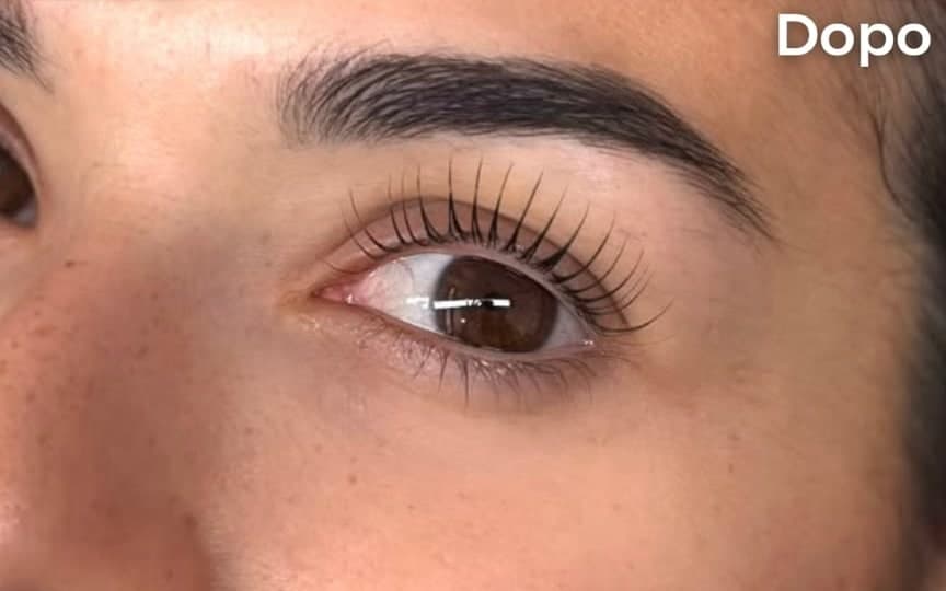 Prima e dopo di un Korean Lashlift, quinto caso