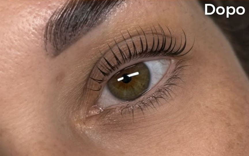 Prima e dopo di un Korean Lashlift, sesto caso