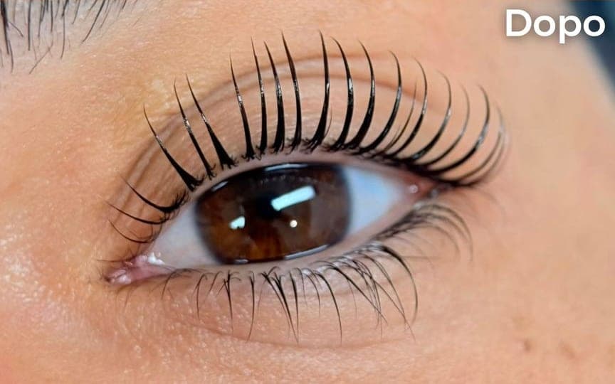 Prima e dopo di un Korean Lashlift